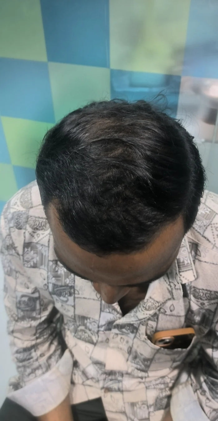 After treatment