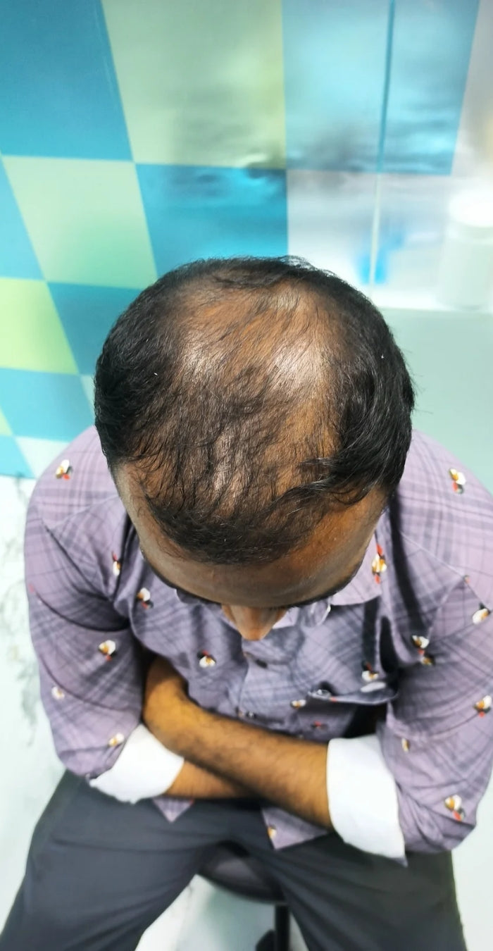 Before treatment