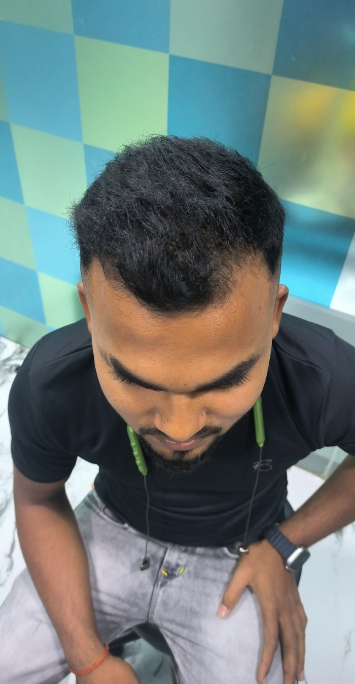After treatment