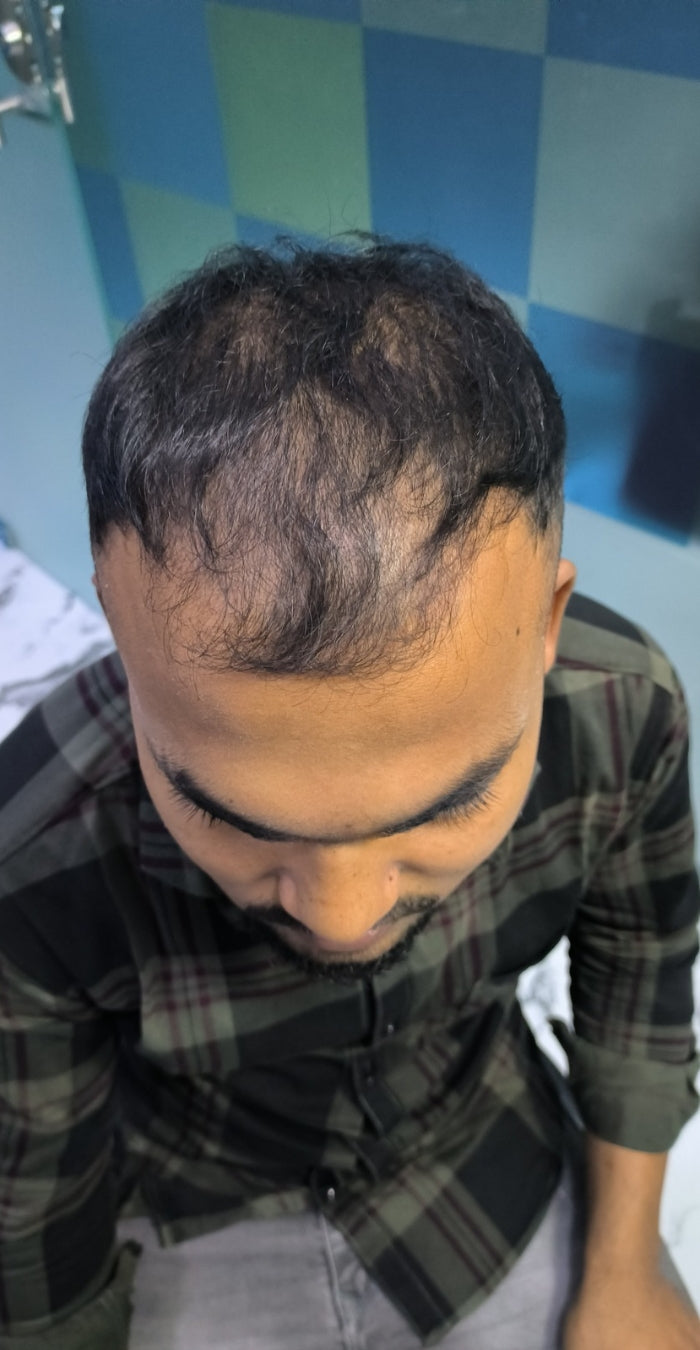Before treatment