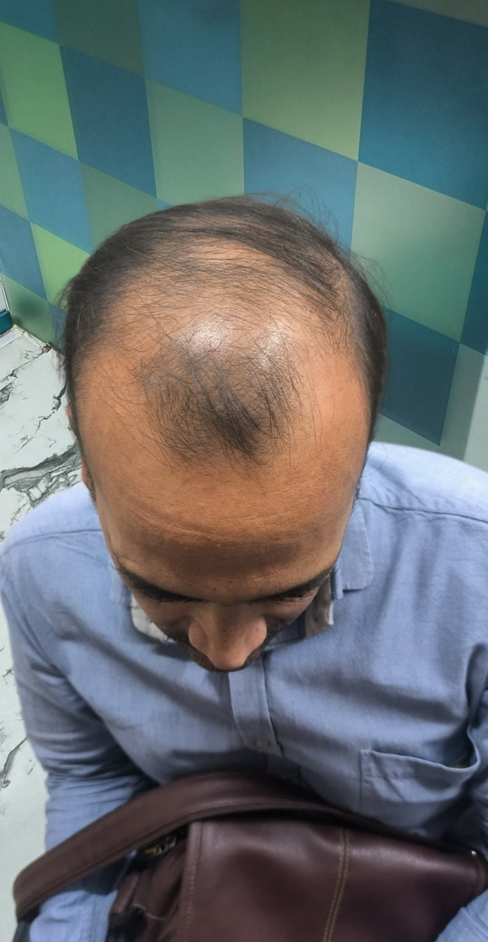 Before treatment