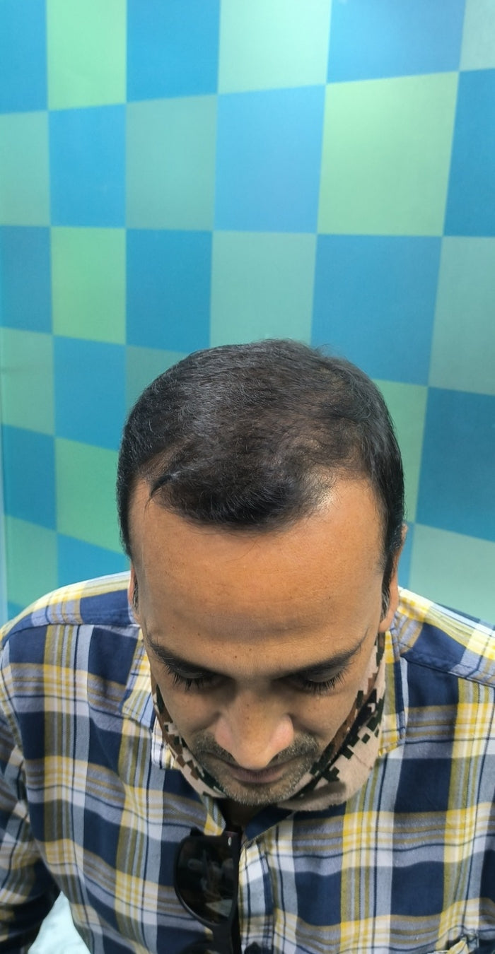 After treatment