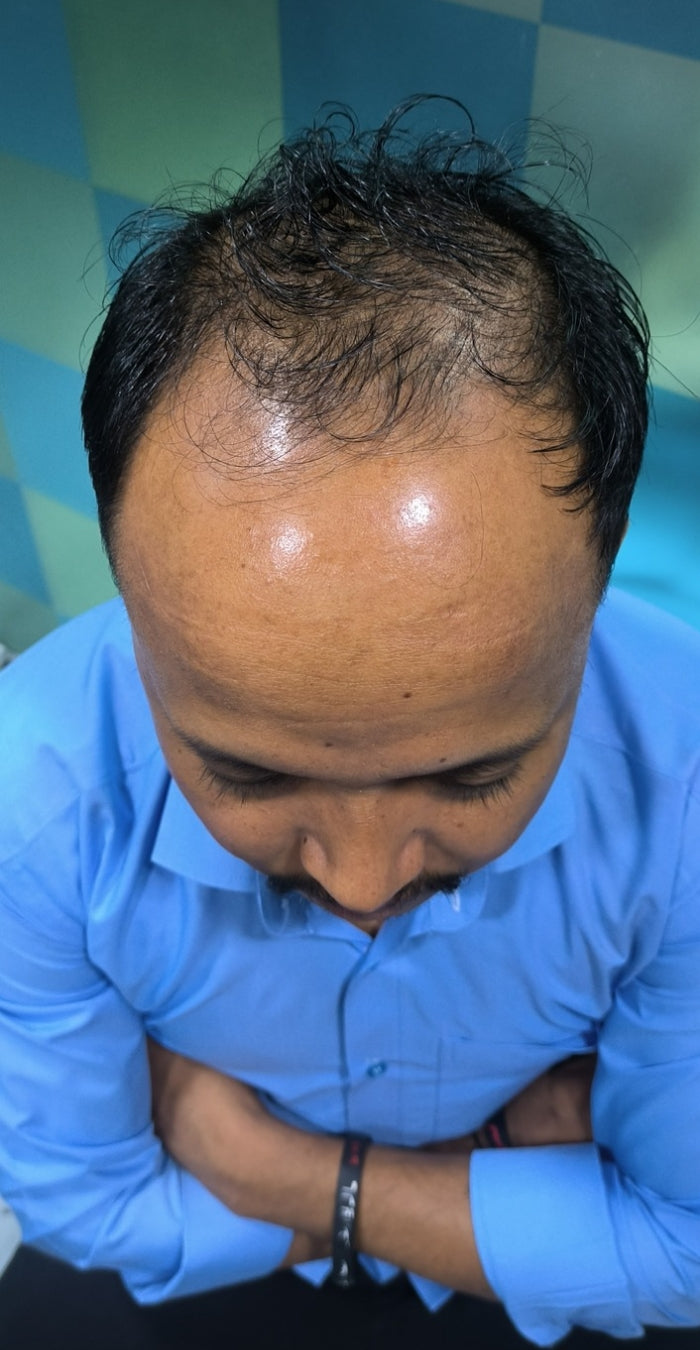 Before treatment