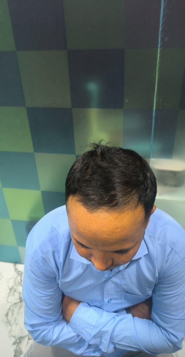 After treatment