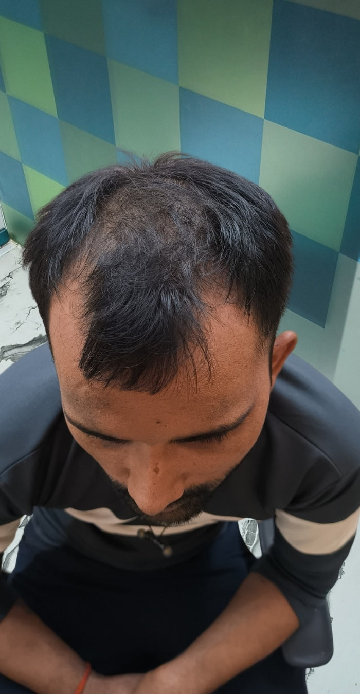 Before treatment