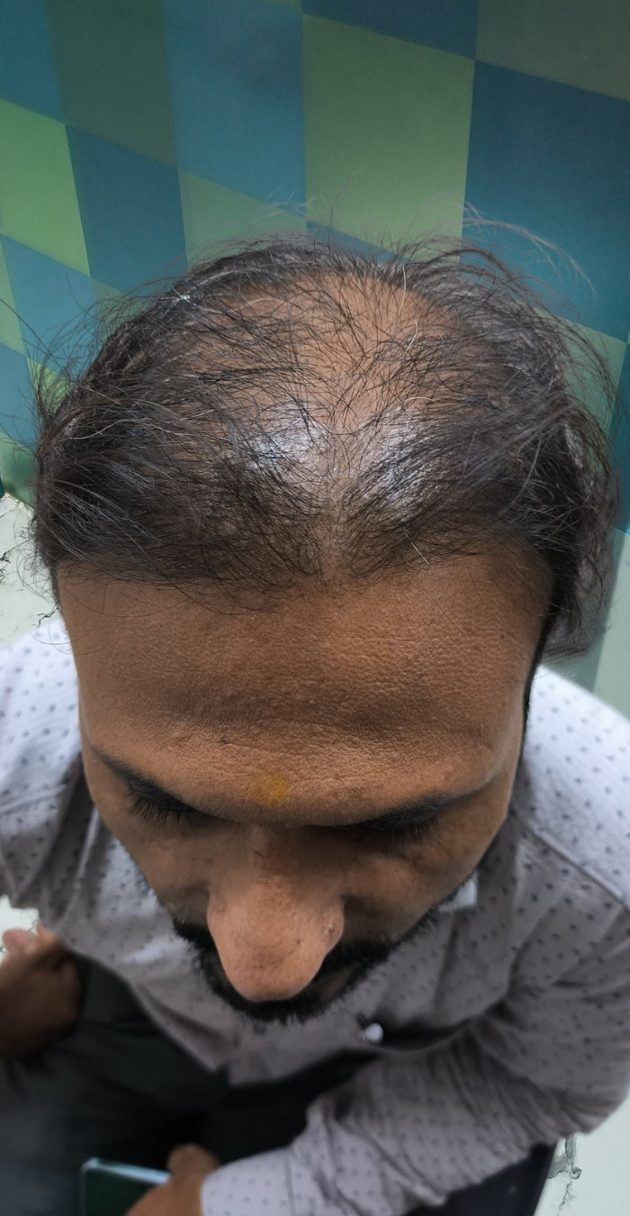 Before treatment