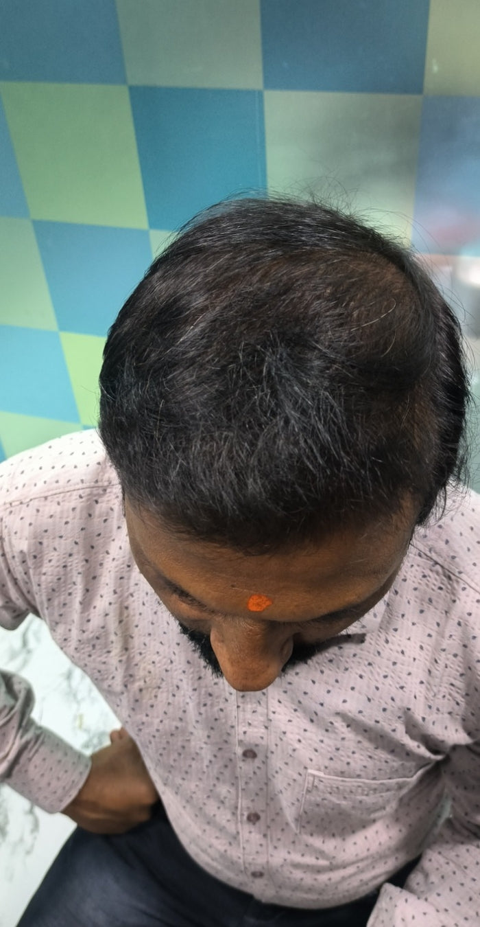 After treatment
