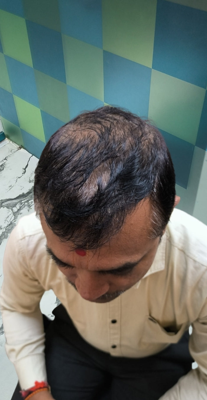 Before treatment