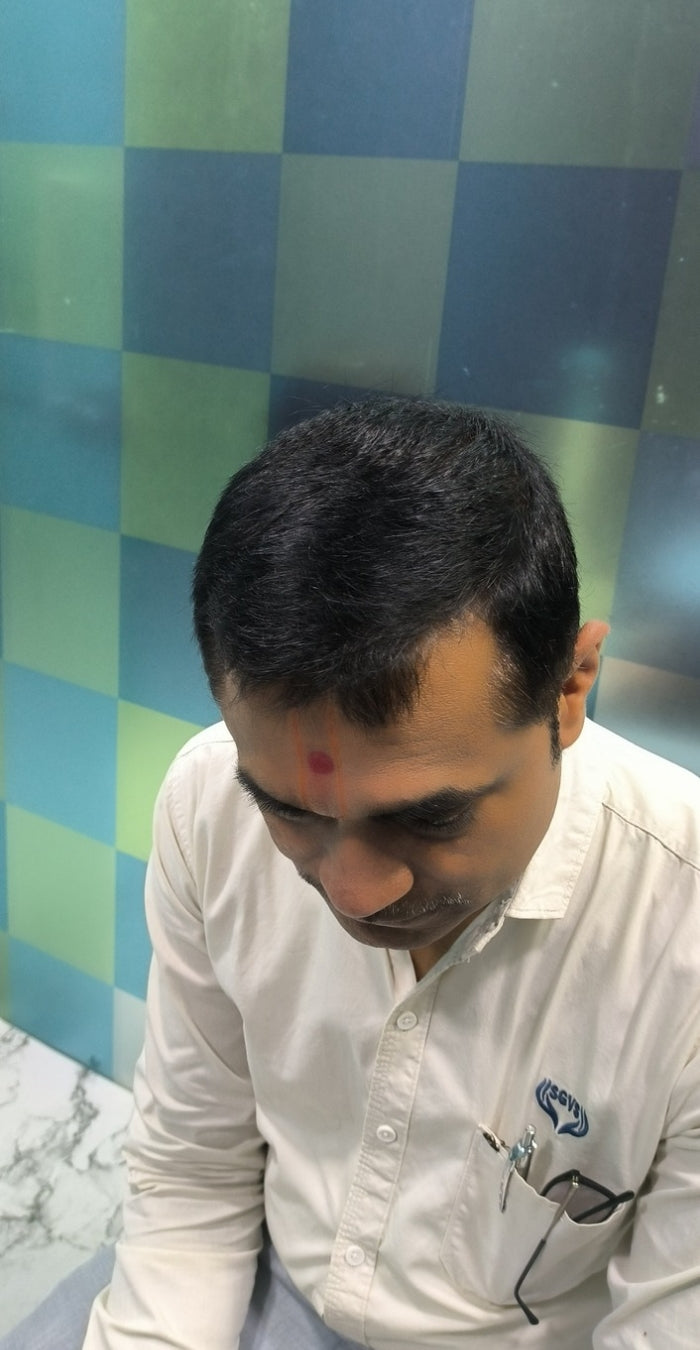 After treatment