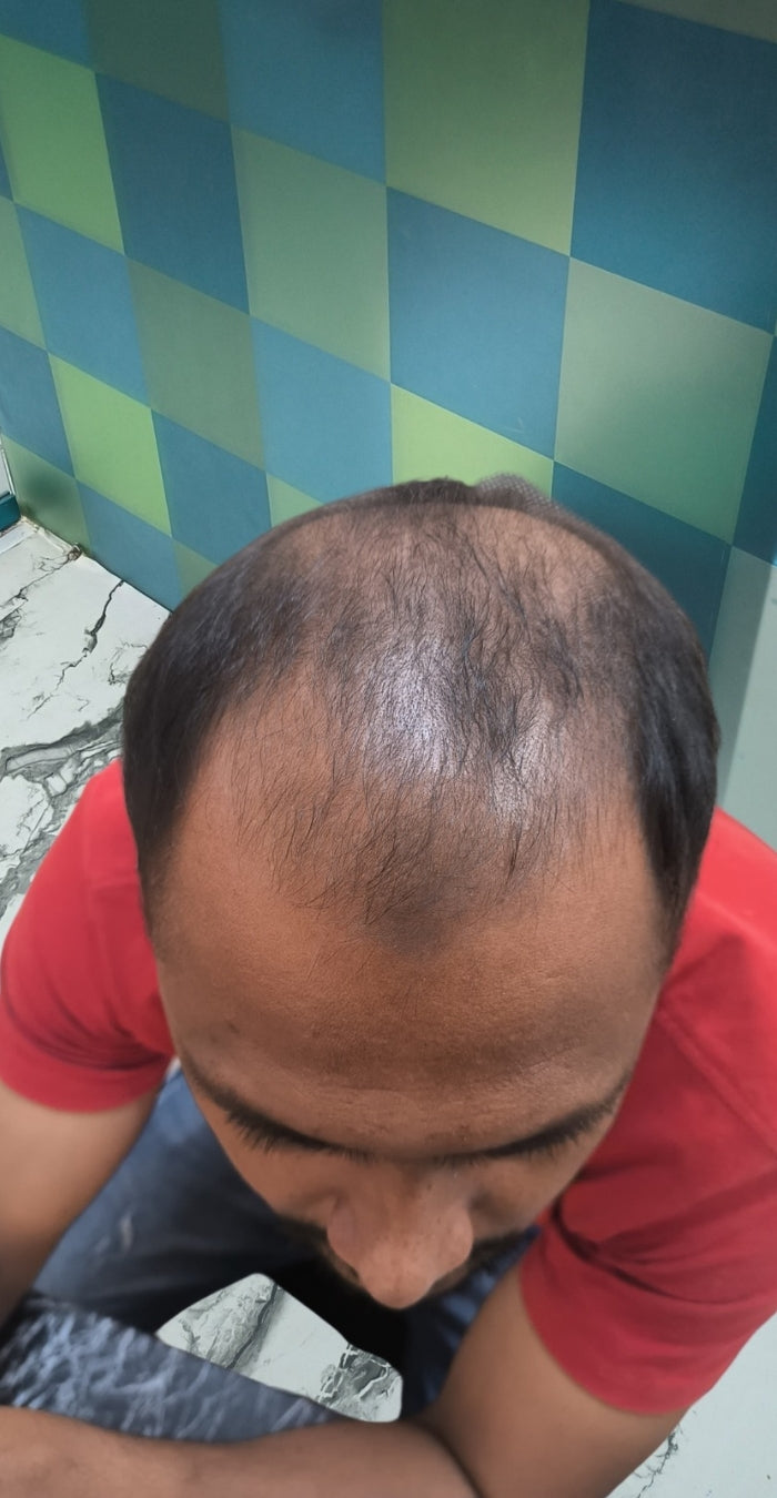 Before treatment