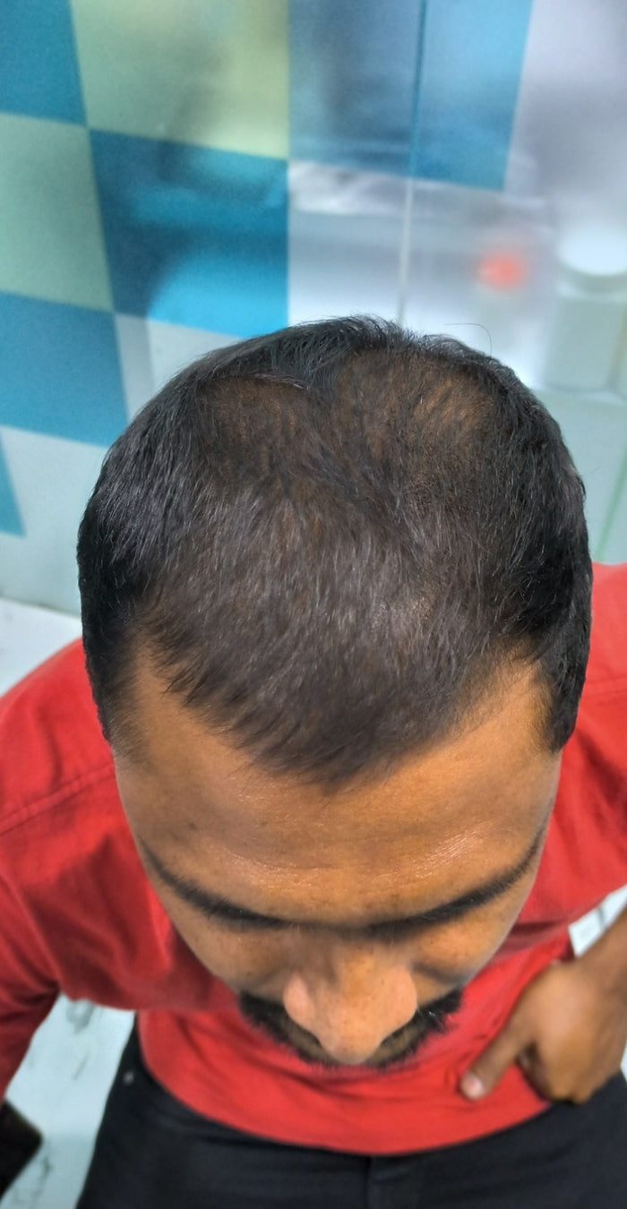 After treatment