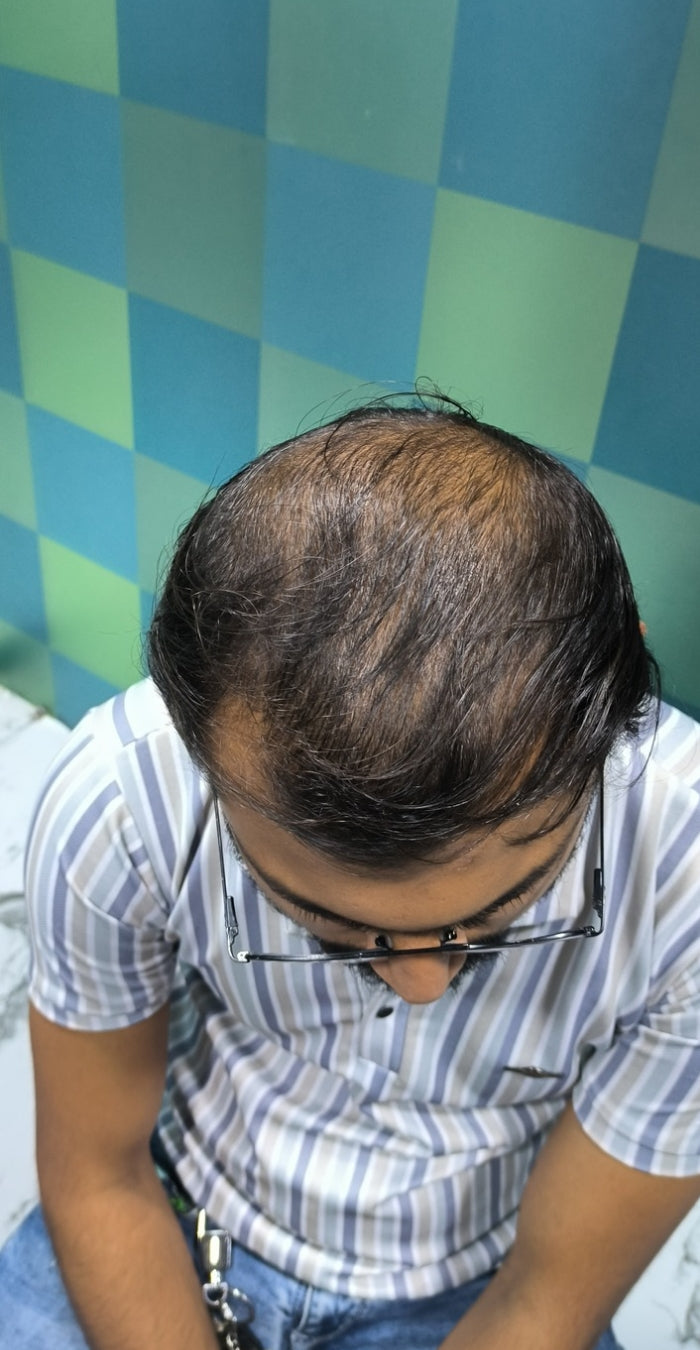 Before treatment