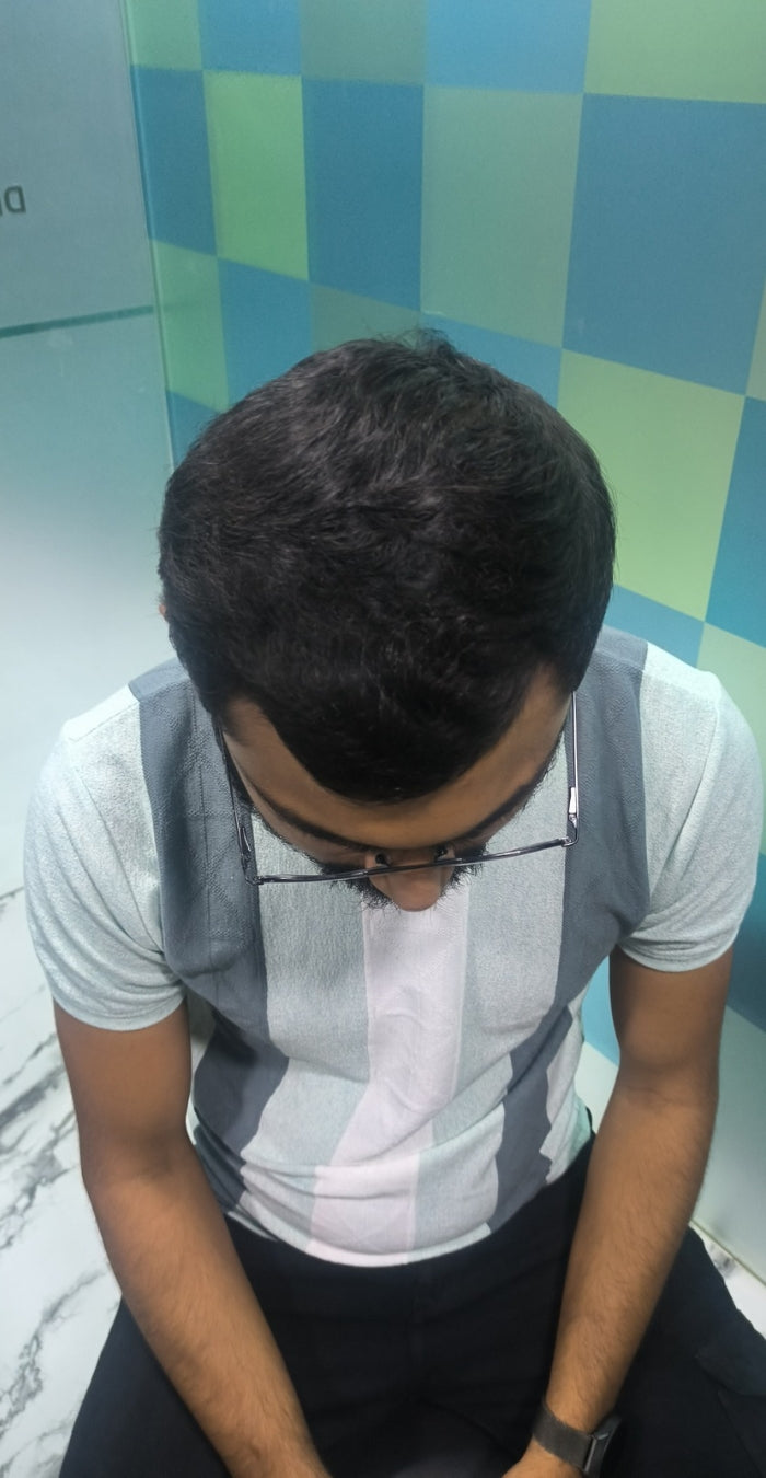 After treatment