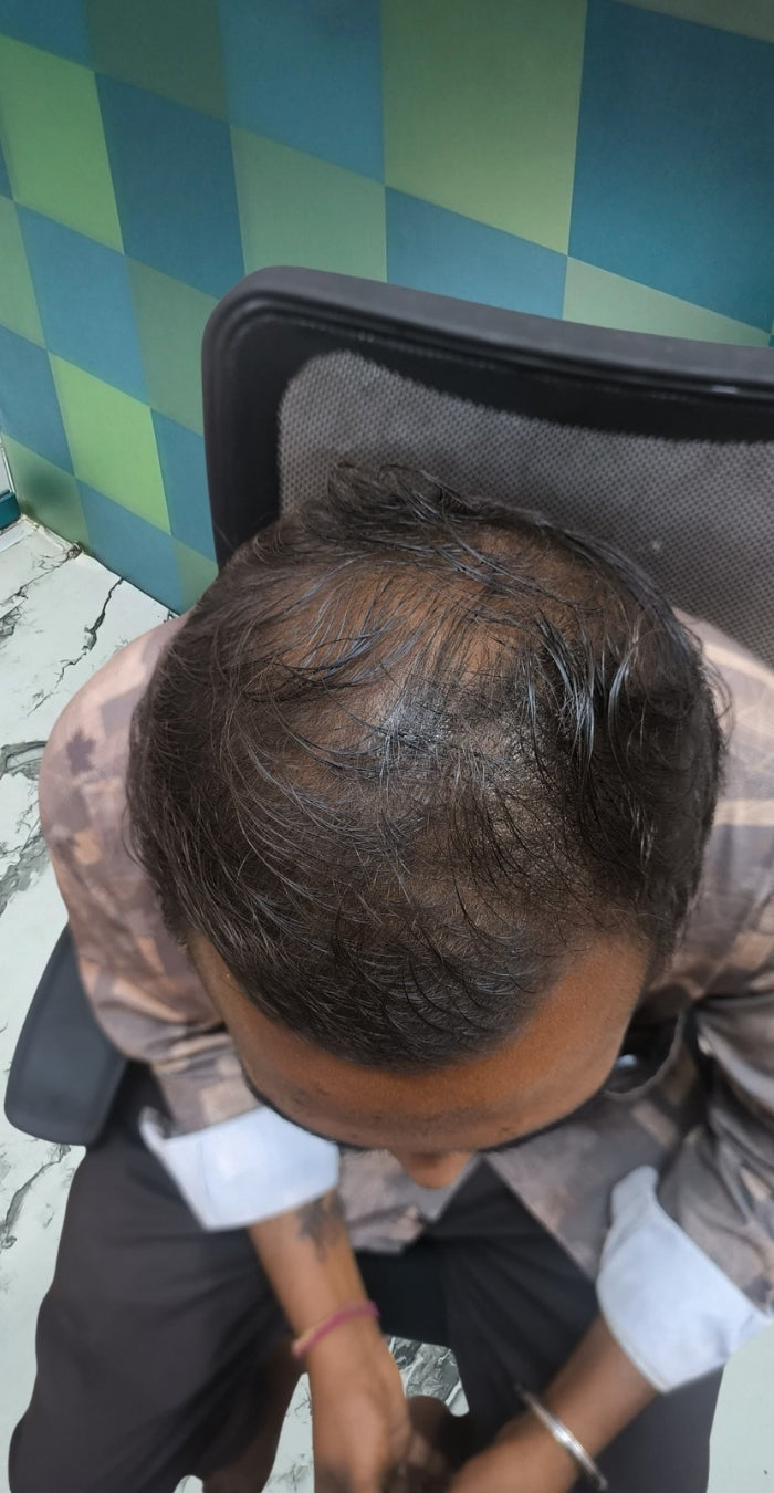 Before treatment