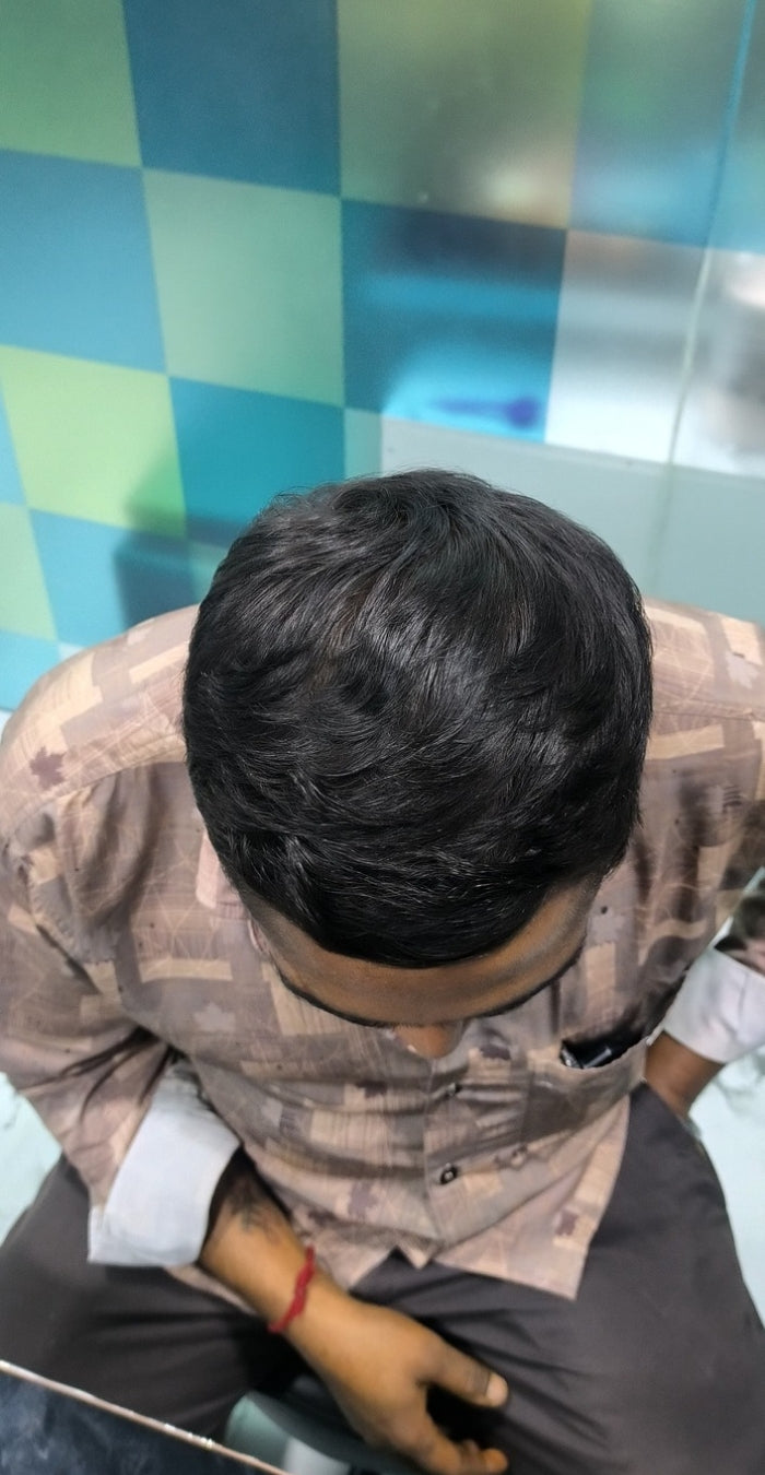 After treatment