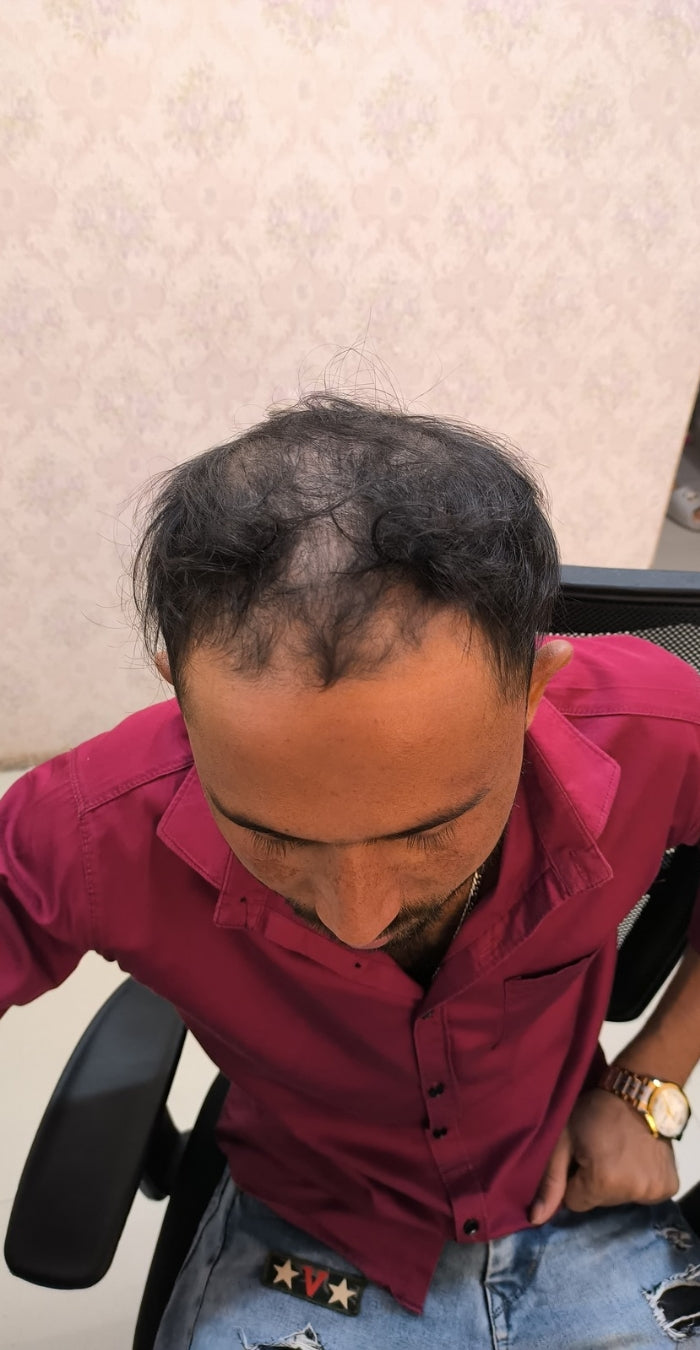 Before treatment