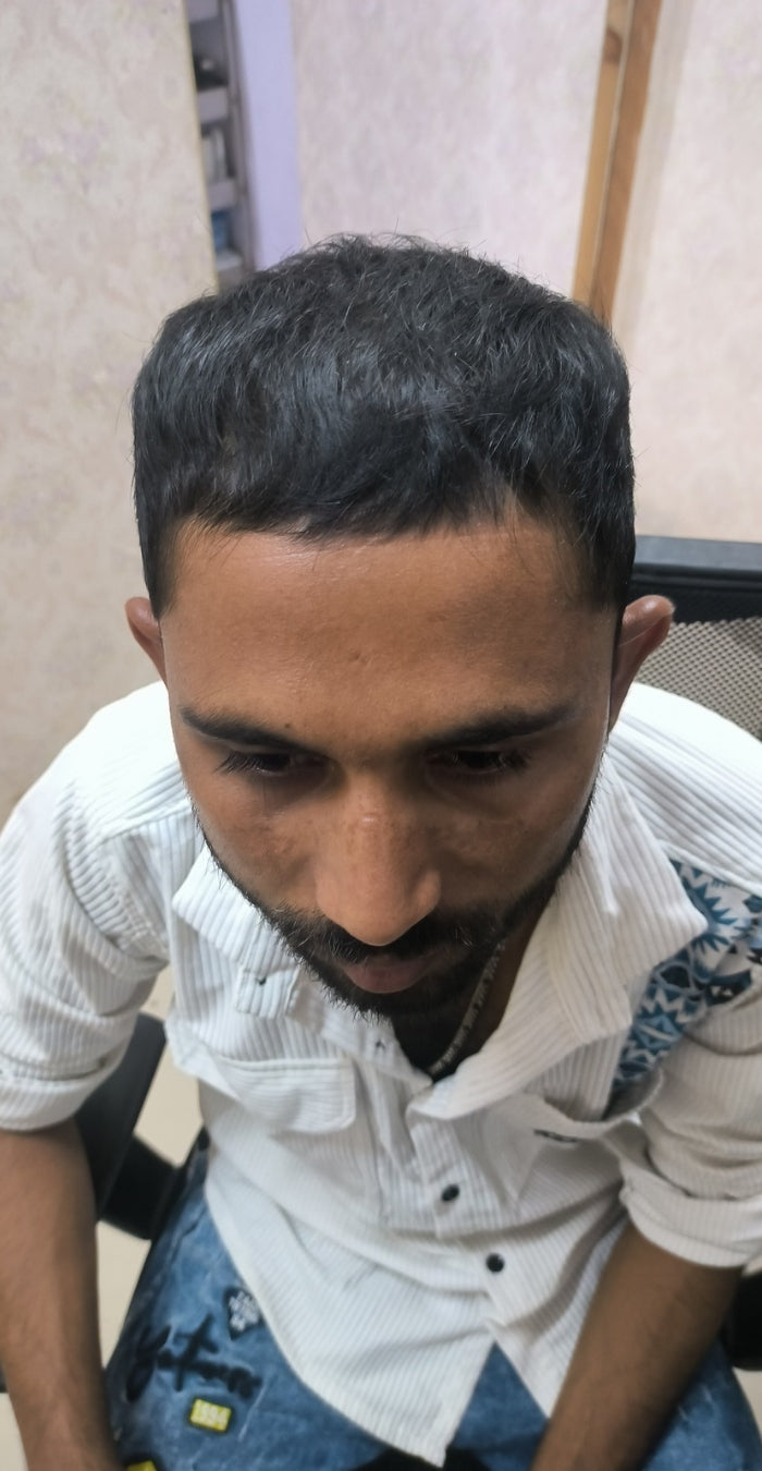 After treatment