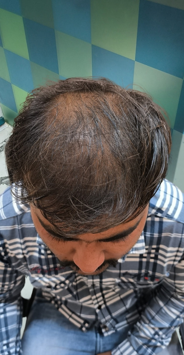Before treatment