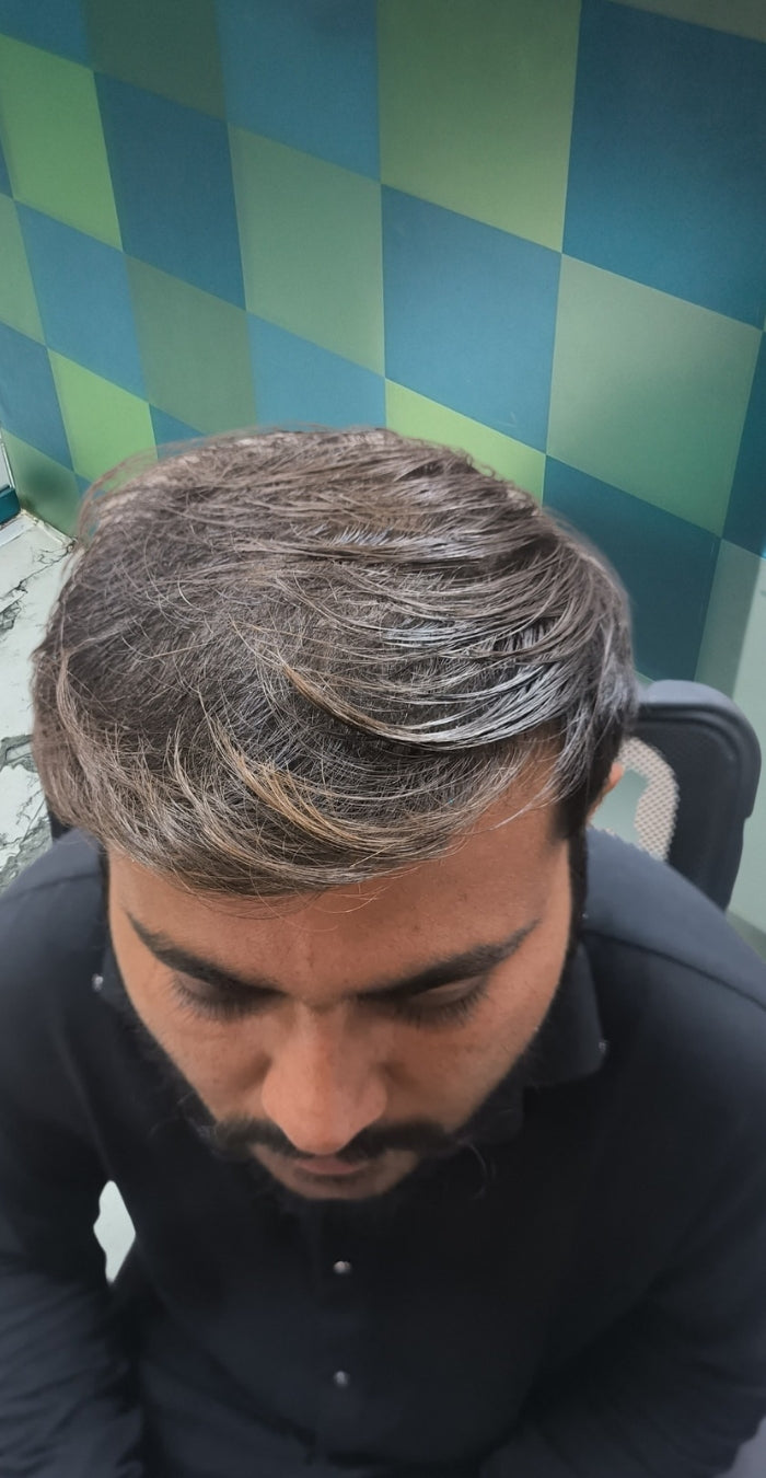 After treatment