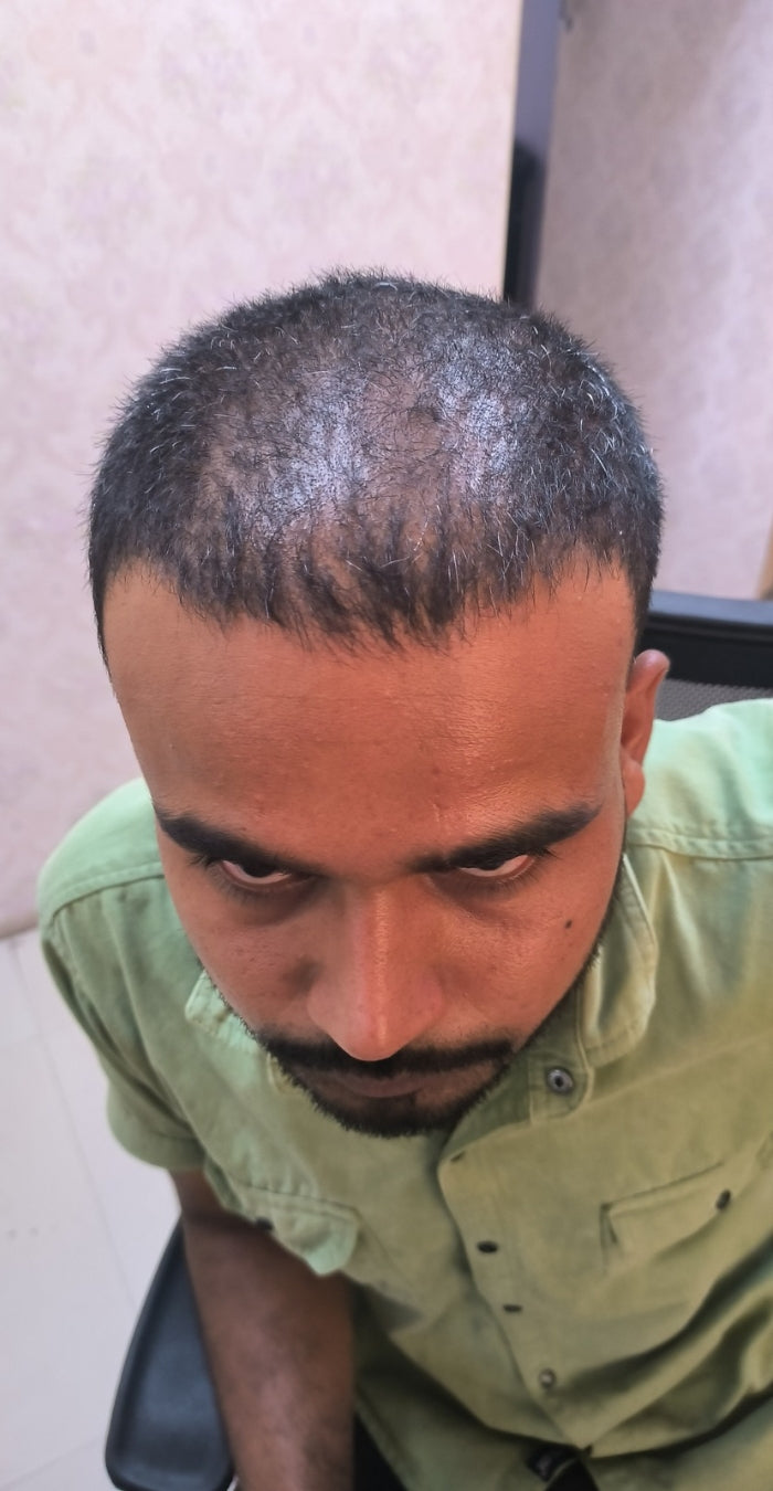 Before treatment