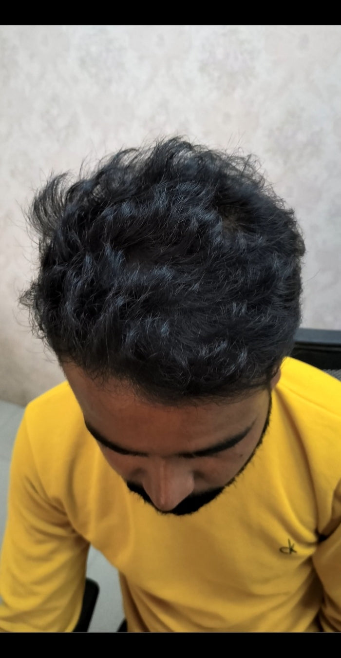 After treatment
