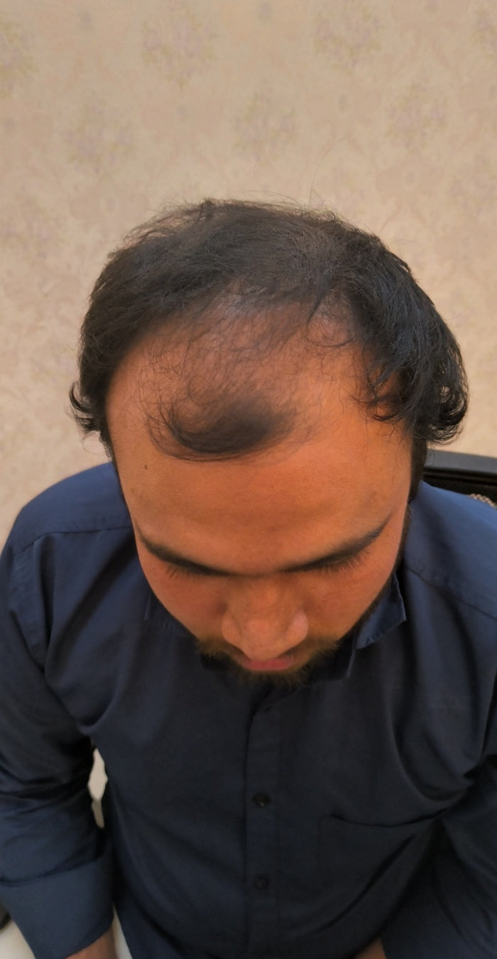 Before treatment
