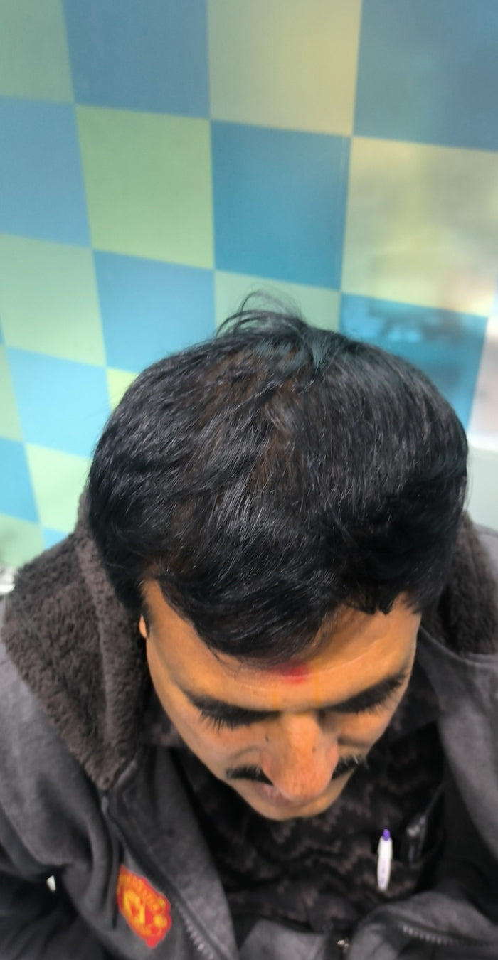 After treatment