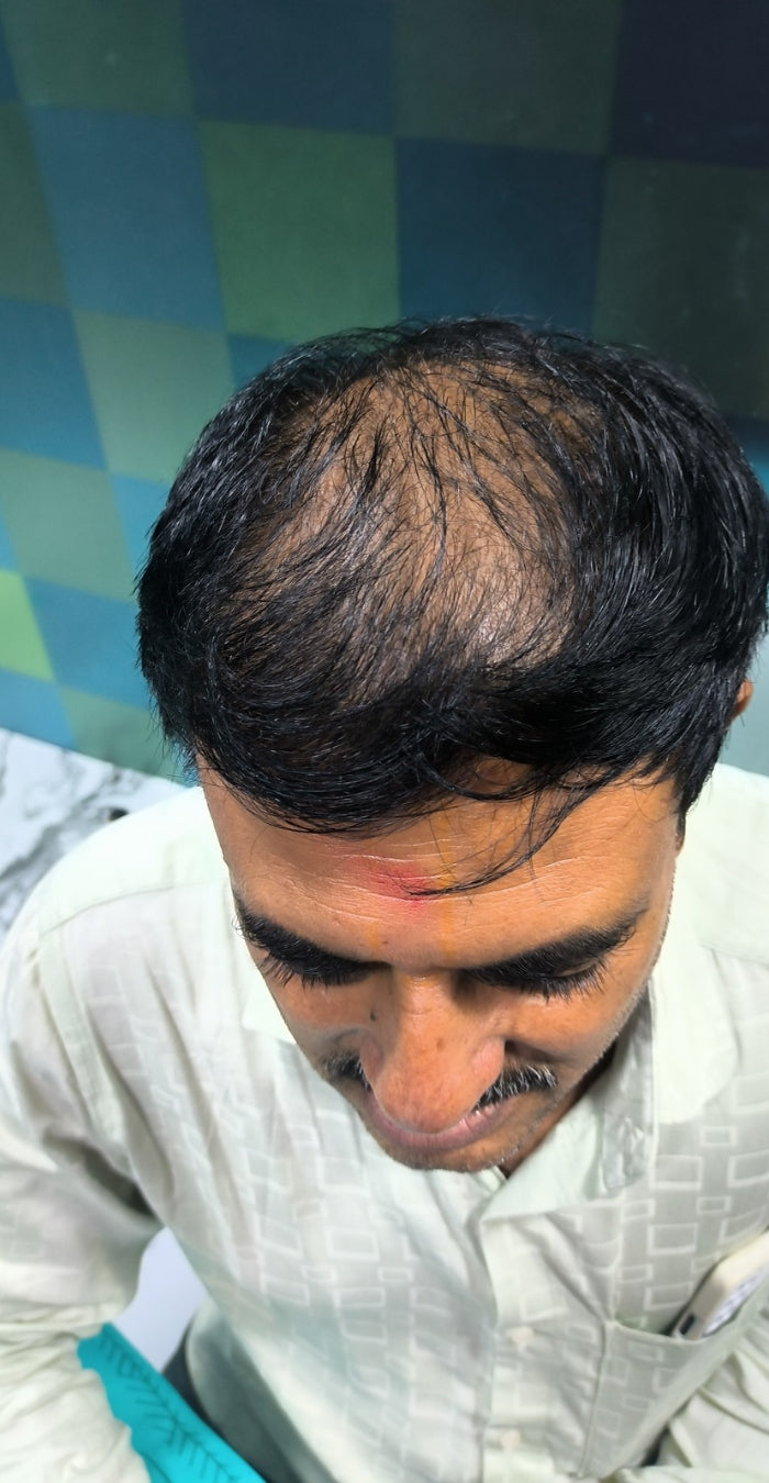 Before treatment
