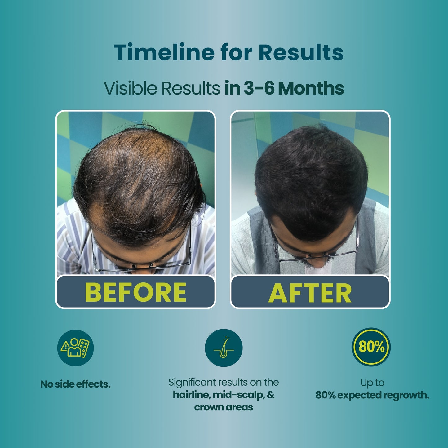 Advanced Hair Growth Kit