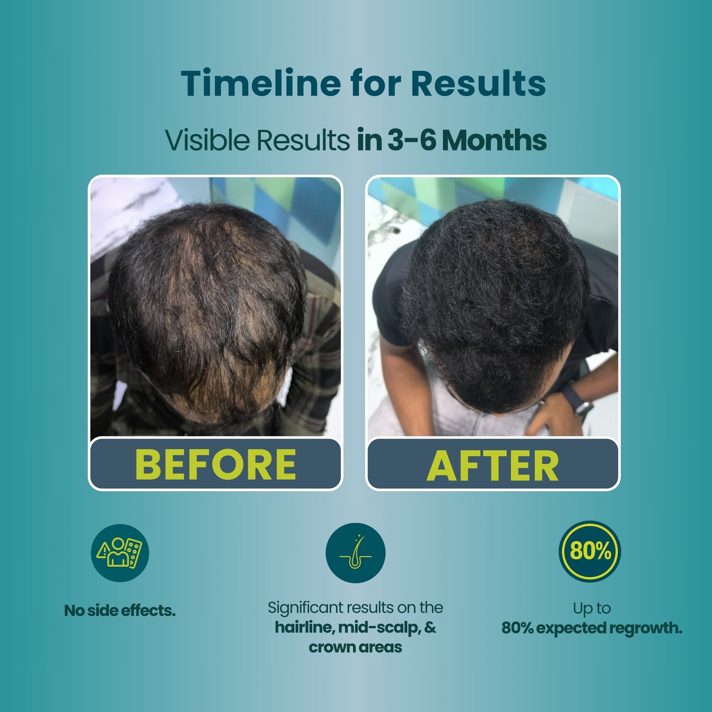 Anti Dandruff + Hair Growth Kit Box