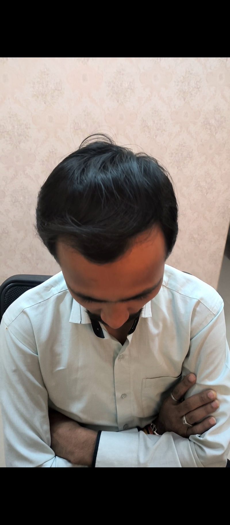 After treatment