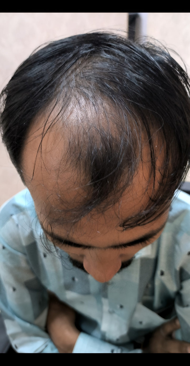 Before treatment