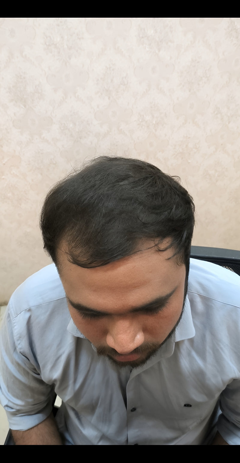 After treatment