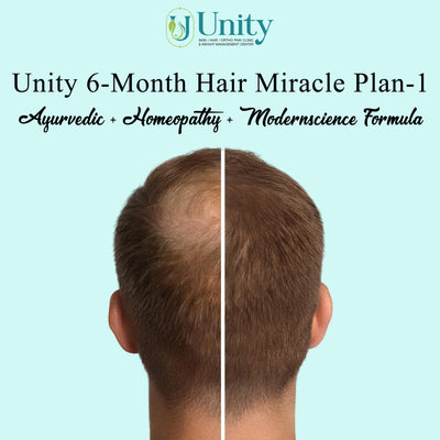 Unity 6-Month Hair Miracle Plan-1 (Ayurvedic + homeopathy + modernscience formula)