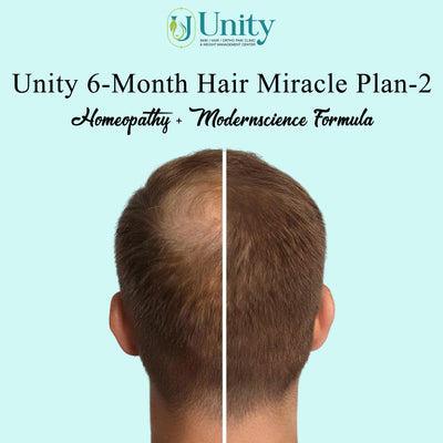 Unity 6-Month Hair Miracle Plan-2 (homeopathy + modernscience formula)