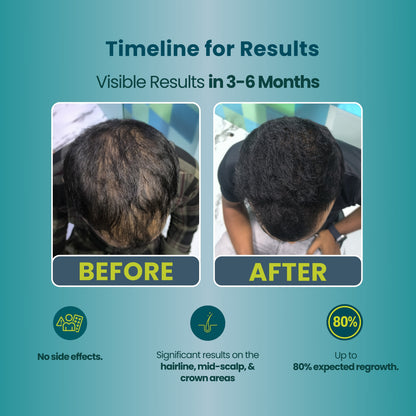 Anti Dandruff + Hair Growth Kit Box